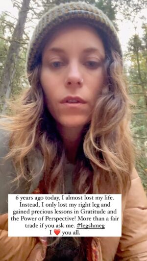 Savannah Welch Instagram - 6 years ago today, I almost lost my life. Instead, I only lost my right leg and gained precious lessons in Gratitude and the Power of Perspective! More than a fair trade if you ask me. #legshmeg I ❤️ you all.