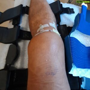 Sean Waltman Instagram - Today was my 1st appointment 6 days after surgery. Still swollen. The pain has been tolerable. I only used 1/2 /the pain medication I was prescribed. Anyways, just wanted to check in. Thank you to everyone who reached out. Means a lot to me.🙏