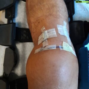 Sean Waltman Instagram - Today was my 1st appointment 6 days after surgery. Still swollen. The pain has been tolerable. I only used 1/2 /the pain medication I was prescribed. Anyways, just wanted to check in. Thank you to everyone who reached out. Means a lot to me.🙏