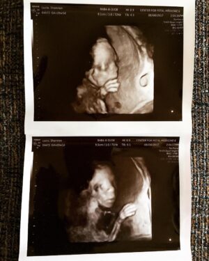 Shannon Lucio Instagram - Only 2 weeks left until we meet this dude.  I’m about to be a parent!  What the F?! I think I’ve fallen through the looking glass.  #baby #ultrasound #firsttimer #littledude #actress #stagemom #changes