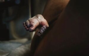 Sherry A. Ross Instagram - Feet first! This accounts for less than 5% of deliveries and typically, delivery by c-section is the safest route. Incredible #FotoFriday image by @birth_day_geboortefotografie