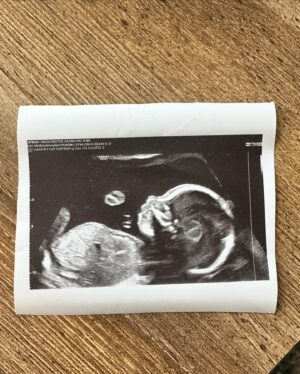 Sigurbjörg Alma Ingólfsdóttir Instagram - March photo dump 📸☺️filming, baby, up-cycling, writing a new tour, eating cupcakes, getting lots of new hairs that stick out, spring time and bump 🤰🏼♥️🥰