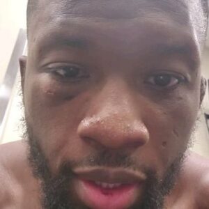 Sodiq Yusuff Instagram - Rough night. I will be ok. Thank you for everything @lloydirvin @coachdorianprice @gberggg
