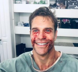Stephen Huszar Instagram - Feelin’ RABID? Happy Halloween! 🎃 
#horrormovies @soskasisters #Rabid #cronenberg #remake #halloween