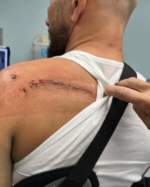 TJ Dillashaw Instagram - Going full battle mode for this recovery.