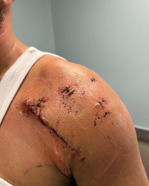 TJ Dillashaw Instagram - Going full battle mode for this recovery.