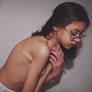 Taisiya Sheremet Instagram - Честно… я переписываю этот пост раз двадцатый и все еще не знаю что ж мне блять сказать… В сущности нечего, я просто хочу чтобы вы знали — государство в очередной раз пытается нас убить. Нас 4.000 человек на всю Россию, у каждого из нас муковисцидоз
⠀
Муковисцидоз без адекватного лечения это мучительная и очень страшная смерть от инфекции, удушья, худобы. Сами посудите:
⠀
Пища не усваивается, у пациента постоянные поносы и рвота. Человек совсем не набирает вес, а легкие забивает густая слизь, в ней заводятся разные бактерии, вызывающие интоксикацию. Человека лихорадит. Слизь мешает вдохнуть, ты тонешь в ней, легкие слипаются и срастаются, потом появляются разрывы, кровотечения и рубцы. Потом цирроз печени, отказывают почки, не выдерживает сердце — тахикардия, одышка, обмороки, кислородное голодание. Психика тоже сдает: депрессивные эпизоды, нежелание лечиться и суицидальные мысли… Ну а конец вы знаете, в России он наступает в 18-20 лет
⠀
Страшно ведь так?
А знаете что еще страшнее?
⠀
Знать, что с муковисцидозом можно жить иначе, знать что во всем цивилизованном мире уже нет этих ужасов. Вместо них — бесплатная базовая терапия, с которой МВ пациенты счастливо живут до пенсии.  Здорово правда? А вот у нас не здорово, у нас страшно, у нас  государство насильно вписывает тебя в тот сценарий с мучительной смертью от удушья
⠀
…
⠀
У муковисцидоза есть стандарт лечения:
⠀
▫️Фармакология: ферменты для набора веса, высококалорийное белковое питание, доступные оригинальные антибиотики, чтобы уничтожать инфекцию в легких, препараты для печени и почек, препараты для разжижения мокроты
▫️Приборы и расходники: ингаляторы, тренажеры дыхания, дренажные батуты и жилеты, пульсоксиметры, гастростомы, инсулиновые помпы, а еще трубки, переходники, сменные блоки и фильтры для всего этого
▫️Услуги: скрининг, полное обследование раз в полгода, регулярные биохимии и посевы. Еще помощь врачей, медсестер, физиотерапевтов и психологов. ▫️Специальные больницы для МВ больных в которых стерильно и нет перекрестного инфицирования
⠀
И этот стандарт работает, да он не устраняет первопричину, но зато сводит последствия болезни к минимуму. Эту терапию в полной мере уже сейчас получают люди
⠀
Далее