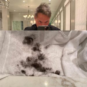 Terry Dubrow Instagram - F it. I did it myself. #Botched