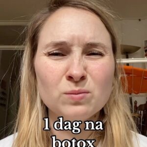 Titia Hoogendoorn Instagram - Ik heb botox in mijn frons genomen tegen migraine. Binnenkort een langere video met de kosten en of het werkt!