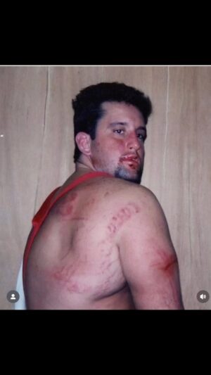 Tom Laughlin Instagram - Every scar has a story on the journey of Extreme