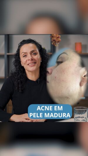 Vanessa Machado Instagram - Vídeo novo no canal do YouTube e o assunto é acne adulta. Está cheio de dicas valiosas que vão te ajudar nesta fase. Link na bio