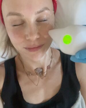 Vlastina Svátková Instagram - Chodím jen na neinvazivní metody, což znamená žádné hlubší zásahy do obličeje, žádné operace, liftingy, řezání.
Snažím se jen pleť udržet v kondici, vyživit ji, podpořit v tvorbě kolagenu.
Nechci vypadat jinak, nechci vypadat o deset let mladší, než jsem, chci mít hezkou, zdravou, šťavnatou pleť. Tak!!!
Kdysi jsem do @klinika_formositas chodila na Exilis a byl skvělej! Teď ho ale nahradil přístroj Endymed, který se dostává účinkem do hlubších vrstev kůže, vytváří takové teplo, které nepálí, ale neuvěřitelně funguje. 
Jak? Prostě nikdo nemá pocit, že vypadáš divně, že to nejsi ty, ale naopak všichni říkají, že vypadáš nějak odpočatě a spokojeně. 
Mně hned po první ošetření zmizela periorální dermatitida na bradě, která se objevila z ničeho nic a nešlo se jí dva měsíce nijak zbavit. Ale nakonec díky bohu šlo…. děkuju!
.
.
#endymed #formositas @klinika_formositas #zdravaplet