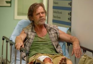 William H. Macy Instagram - On this week’s episode of #Shameless...Frank breaks his leg. Wait till you see it. It’s seriously gross. The guy talking to me in the third picture is Iain B. MacDonald. One of my favorite directors. When he’s sober, he’s awesome. #OnlyOnShowtime