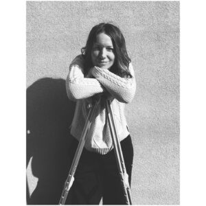 Zuzana Smatanová Instagram - Mám za sebou prvé dva týždne na barlách…💪🏼 ešte musím zvládnuť zvyšné štyri a potom spolu skáčeme 🤸🏻‍♂️ čoskoro čakajte ďalšiu hudobnú novinku!! 😉 z.
.
#zuzanasmatanova #novinky #coskoro #kamosky #bakule