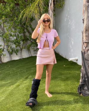 Abby Rao Instagram - Swipe to see my broken foot lol 🥺🤣