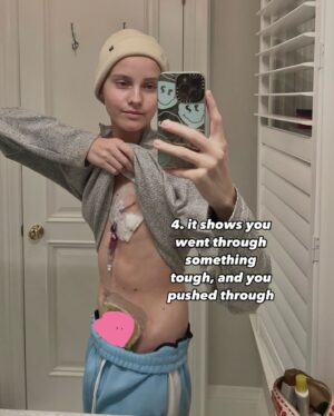Ben Grosskopf Instagram - a “perfect body” doesn’t mean shit if you’re ugly on the inside ❤️‍🩹