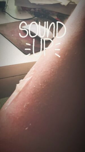 Brendan Fehr Instagram - #sunburn #peeling