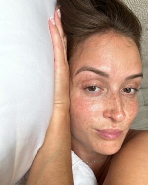 Camille Dufresne Instagram - Keep calm and freckle on