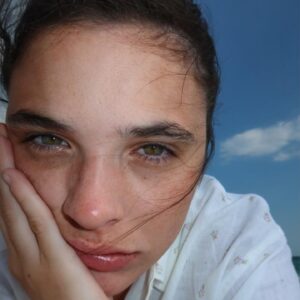 Connar Franklin Instagram - uv rays are 11 & freckles are out.