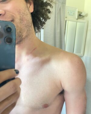Damon J. Gillespie Instagram - We love them fight club hotties and scars don’t we? 😉

@giuseppebausilio @sydneyculbertson @thepowerofadante @sydneyculbertson 
@ben_jam_ink