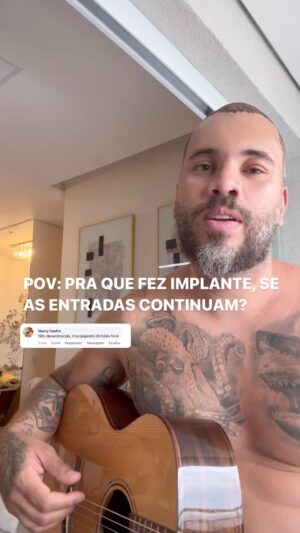 Eden Rodrigues Instagram - A internet está cheio de especialistas em tudo né @dr.vlassiosmarangos 😂😂 #implanteCapilar
