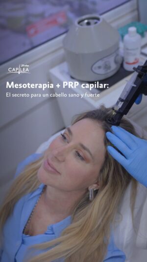 Flaviana Seeling Instagram - Acompáñanos en una sesión de cuidado capilar con @flavianaseeling 🤩

En su caso, preparamos un tratamiento estimulativo que combinó PRP capilar   mesoterapia capilar, un mix súper potente y efectivo para:

✨Fortalecer el cabello.

✨Estimular el crecimiento.

✨Aumentar la densidad.

✨Mejorar la calidad y grosor del cabello.

✨Revitalizar el cuero cabelludo.

¿Quieres saber más sobre nuestros tratamientos? Consúltanos por WhatsApp o mensaje privado y agenda una cita de diagnóstico en Capilea.

📲 Sede Talca:  56 966 224 113
📲 Sede Concepción: 56 923 968 588