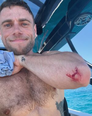 Gus Kenworthy Instagram - I took a spill in Ibiza