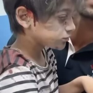 Haluk Piyes Instagram - - …but, Do you Condemn Hamas? -

How dare u can still ask this???

 In Gaza 7326 dead including 3038 children and 1792 women. The wounded are 18967. Among these hundreds and hundreds without legs and arms. Meanwhile a consistent slice of western press, in the midst of a disgusting carnage, the only question they can ask is this... This baby has survived, so far.
Look for yourself the terror of war, the terror of bombing just now.
This is not self-defense. This is genocide. Can that barbaric terrorist attack justify a retaliation that goes infinitely beyond the law of bribery?
Do you realize that these children can't even escape living in Gaza, therefore in the biggest prison in the world for 75 years? Rightly, I repeat, rightly have been shown in national news the images of the indecent terrorist attack by Hamas. Why aren't these images shown too? Why? Why? This isn’t about Hamas and revenge….USA Austria and Germany are no suprise for us but some abstentions will not be forgotten!!! 

#LiberatePalestine
#GazaGenocide