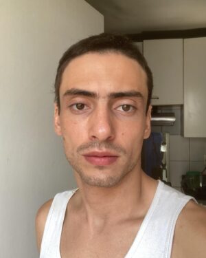 Jaffar Bambirra Instagram - antes, durante, depois