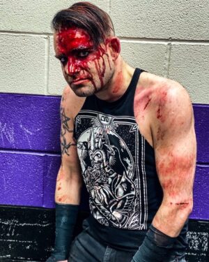 James Mcahren Instagram - Fun times with weapons! 
Before and after. Went as well as could be expected really.