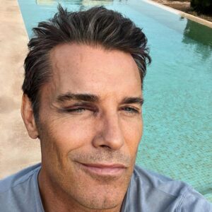 Jesús Vázquez Instagram - Accidente veraniego sin muchas consecuencias 😱
ya pertenezco al club de los ojos morados😜(echadle un vistazo en internet)
