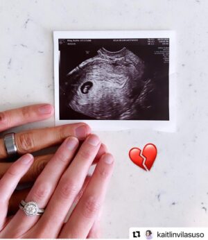 Jordi Vilasuso Instagram - Thank you for your strength and your vulnerability my love. Whatever this means to our story...God only knows and I pray your testimony will bring peace to someone who has faced this as well🙏❤️🙏❤️⁣
#Repost @kaitlinvilasuso⁣
⁣
It’s been a week   1 day since I heard ‘Well, I see the baby. But I’m not seeing the heartbeat.. ohh... wait, there’s a flicker.. oh there’s another flicker.. yeah, no.. that’s not enough.. ‘ 💔💔💔⁣⁣
⁣⁣
That’s not enough. My baby. Our baby. The baby my girls had crossed their fingers for at lunch a few weeks ago, completely unaware that just a few days before I had visited my doctor for what I thought was a precautionary cervix check and a chance to see the heartbeat of our third little one. But instead I was given the ‘50/50’ odds that my dates were ‘off’ and everything was fine OR that it was an ‘abnormal pregnancy that would eventually end in miscarriage.’ Four long, emotionally and physically painful weeks later, I clearly got the latter. ⁣⁣
And I never anticipated that it would hurt this much. ⁣⁣
⁣⁣
I know that miscarriage has a stigma surrounding it in a sense, with so many women who have experienced it being hesitant to talk about it. And now, being one of those ‘one in four women’ that I never thought I’d be.. I understand it even more. It’s a different kind of hurt than I’ve ever experienced. It is so personal. It - and the little heartbeat that was lost- almost feels too precious and sacred to be talked about. Just for starters. ⁣⁣
⁣⁣
I was hoping (even when things went super south) that I was documenting what would be a ‘success story.’ That ‘it was a hard road but we kept the faith and it all worked out and here’s a cute maternity picture of the girls holding my belly to announce their new little baby brother or sister!’ (I’m aware that’s not a proper sentence but definitely accurate in terms of how my mind is processing things these days. 🙈) ⁣⁣
⁣⁣
Instead- I’m here trying to figure out what this story is. And what the point of sharing it is because it just seems.. sad. But I know that God doesn’t work like that.. I know that there is absolute purpose in every season.. that (cont’d in comments)
