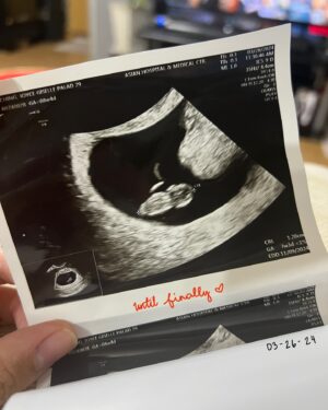 Joyce Ching Instagram - Story time on our pregnancy journey. 🫶🏼 

To all the other wives or mamas out there, we may all have a different timeline, but we do have the same God. Let us all keep on believing and praying. 🙏🏼