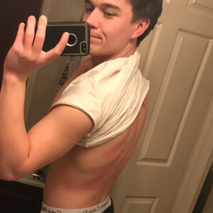 Karl Hughes Instagram - Filming fight scenes today... got a bit injured