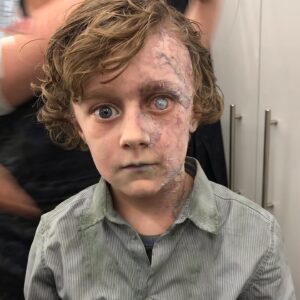 Luke Roessler Instagram - Flashback Friday with creepy photos of last years “The Bad Seed” starring @mckennagraceful and @roblowe.  It’s a remake of the 1956 psychological horror/thriller classic. I even freaked myself out when I rediscovered “Milo” on my camera roll😱!
#thebadseed #mckennagrace #specialeffectsmakeup #spookyseason