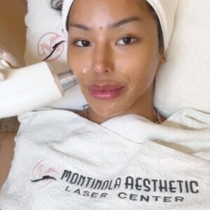 M1ss Jade So Instagram - Kiffy verified ✅

Let me put this up confidently. Diode Laser Hair Removal is that girl who can make your hair growth gone permanently. It’s an addition to my maintenance at @montinola_aesthetic. If you’re looking for one, go get it and own your Goddess-self. Don’t forget to use the code M1ssJade25OFFDiode for 25% OFF on Diode Laser Hair Removal procedures.

#MontinolaBaby