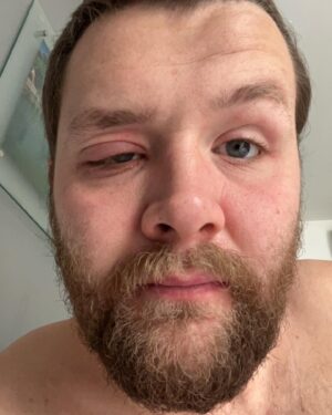 Martin Lepperød Instagram - Var med på lørdagsrådet i helgen og ble kalt elegant, så her kommer tre elegante bilder tatt av @dr.jones og et humorbilde med allergi som tema tatt av meg selv.  god søndag❤️