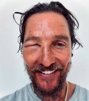 Matthew McConaughey Instagram - bee swell