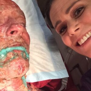 Melissa Ponzio Instagram - #MoonDayMemories #TeenWolf BTS ::: Burnt to a crisp before, during and after with @shelleyhennig & @ianbohen