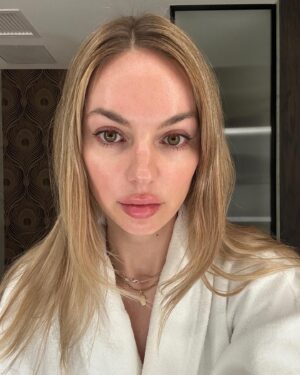 Michelle Mylett Instagram - @relativskin