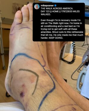Mike Posner Instagram - Five years ago I was bitten by a venomous rattlesnake and almost lost my leg. This was quite inconvenient since I was in the middle of trying to walk across America. 

I spent 3 nights in the ICU, my leg swelled to the size of an elephant trunk, and I went from walking 24 miles a day to not being able to walk to the bathroom.

But eventually, my leg healed, by the grace of God, my leg healed.

Eventually, I went back to the exact spot that the snake bit me and I started taking steps. Not letting the bite stop me made me feel like the superhero version of myself. 

It’s funny, because getting bit by the snake was scary and annoying, to say the least at the time.

But now, it’s one of the defining moments of my life. That snake venom proved to be poison for my body but medicine for my soul. 

It taught me that I was way stronger than I thought I was. My soul is unbreakable. My determination is invincible. Nothing can stop me.

I kept taking steps until I had walked all the way across the United States of America. 

Everybody has snakebite moments in their life. 

Everybody has painful moments that ruin your plans and devastate your foundations of who you thought you were. 

Someone reading this in a “snakebite moment” right now.

The following words are for you. 

The pain you are experiencing now may be the very pain you are grateful for later. 

Keep going.
