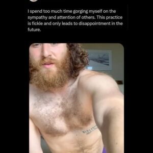 Mike Posner Instagram - Five years ago I was bitten by a venomous rattlesnake and almost lost my leg. This was quite inconvenient since I was in the middle of trying to walk across America. 

I spent 3 nights in the ICU, my leg swelled to the size of an elephant trunk, and I went from walking 24 miles a day to not being able to walk to the bathroom.

But eventually, my leg healed, by the grace of God, my leg healed.

Eventually, I went back to the exact spot that the snake bit me and I started taking steps. Not letting the bite stop me made me feel like the superhero version of myself. 

It’s funny, because getting bit by the snake was scary and annoying, to say the least at the time.

But now, it’s one of the defining moments of my life. That snake venom proved to be poison for my body but medicine for my soul. 

It taught me that I was way stronger than I thought I was. My soul is unbreakable. My determination is invincible. Nothing can stop me.

I kept taking steps until I had walked all the way across the United States of America. 

Everybody has snakebite moments in their life. 

Everybody has painful moments that ruin your plans and devastate your foundations of who you thought you were. 

Someone reading this in a “snakebite moment” right now.

The following words are for you. 

The pain you are experiencing now may be the very pain you are grateful for later. 

Keep going.