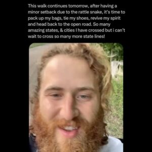 Mike Posner Instagram - Five years ago I was bitten by a venomous rattlesnake and almost lost my leg. This was quite inconvenient since I was in the middle of trying to walk across America. 

I spent 3 nights in the ICU, my leg swelled to the size of an elephant trunk, and I went from walking 24 miles a day to not being able to walk to the bathroom.

But eventually, my leg healed, by the grace of God, my leg healed.

Eventually, I went back to the exact spot that the snake bit me and I started taking steps. Not letting the bite stop me made me feel like the superhero version of myself. 

It’s funny, because getting bit by the snake was scary and annoying, to say the least at the time.

But now, it’s one of the defining moments of my life. That snake venom proved to be poison for my body but medicine for my soul. 

It taught me that I was way stronger than I thought I was. My soul is unbreakable. My determination is invincible. Nothing can stop me.

I kept taking steps until I had walked all the way across the United States of America. 

Everybody has snakebite moments in their life. 

Everybody has painful moments that ruin your plans and devastate your foundations of who you thought you were. 

Someone reading this in a “snakebite moment” right now.

The following words are for you. 

The pain you are experiencing now may be the very pain you are grateful for later. 

Keep going.