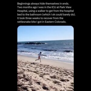 Mike Posner Instagram - Five years ago I was bitten by a venomous rattlesnake and almost lost my leg. This was quite inconvenient since I was in the middle of trying to walk across America. 

I spent 3 nights in the ICU, my leg swelled to the size of an elephant trunk, and I went from walking 24 miles a day to not being able to walk to the bathroom.

But eventually, my leg healed, by the grace of God, my leg healed.

Eventually, I went back to the exact spot that the snake bit me and I started taking steps. Not letting the bite stop me made me feel like the superhero version of myself. 

It’s funny, because getting bit by the snake was scary and annoying, to say the least at the time.

But now, it’s one of the defining moments of my life. That snake venom proved to be poison for my body but medicine for my soul. 

It taught me that I was way stronger than I thought I was. My soul is unbreakable. My determination is invincible. Nothing can stop me.

I kept taking steps until I had walked all the way across the United States of America. 

Everybody has snakebite moments in their life. 

Everybody has painful moments that ruin your plans and devastate your foundations of who you thought you were. 

Someone reading this in a “snakebite moment” right now.

The following words are for you. 

The pain you are experiencing now may be the very pain you are grateful for later. 

Keep going.