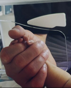 Nathaniel Wood Instagram - I now understand when parents told me your life will change the moment your child is born. 

The most heartbreaking moment I’ve ever had to experience seeing her head off into surgery and having no control, no taking her place, absolutely helpless. 

Today she has come of her sedation and is slowly opening her eyes. My purpose, my world, my absolute love. I cannot wait until I can hold your properly ❤️ 

I hope i can be the best dad and bring you nothing but happiness and make you proud. 

Thankyou everyone for ongoing messages, myself and @laurenjadewood21 truly appreciate you all.