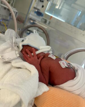 Noémie Abossolo Instagram - Après plus d’un mois et demi d’hospitalisation KAËNY ISMAËL & SHAÏLY ISAAC et moi même avons pu rentrer à la maison 👶🏽🏥
 

Les voir pour la première fois, si petit, si fragile, mais pourtant si fort, a été une expérience bouleversante. Dans leur yeux, j’ai découvert une étincelle de vie et d’innocence, et dans leur  sourire, la plus belle des promesses 💫

MERCI MON DIEU🙏🏾

j’attendais le moment qui me semblait opportun pour vous les présenter ❤️

💇🏽‍♀️ : @wearelocksed