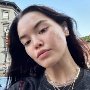 Paris Berelc Instagram - It’s been a journey… as @sarahfordofficial always says, “skin is within.” The past year I have had such a battle with acne… I felt embarrassed to take photos because of the way my skin looked. It can be incredibly frustrating especially when you’re not sure what’s causing it and everything you’re trying isn’t working. With switching birth control, reducing alcohol, eating healthy, and figuring out the right skin routine for me, I finally have a control over my acne. It just takes time babes 🪽