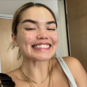 Paris Berelc Instagram - It’s been a journey… as @sarahfordofficial always says, “skin is within.” The past year I have had such a battle with acne… I felt embarrassed to take photos because of the way my skin looked. It can be incredibly frustrating especially when you’re not sure what’s causing it and everything you’re trying isn’t working. With switching birth control, reducing alcohol, eating healthy, and figuring out the right skin routine for me, I finally have a control over my acne. It just takes time babes 🪽