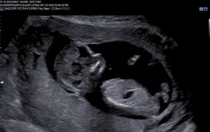 Paul Nassif Instagram - An ultrasound of our baby boy… What a beautiful blessing. No. 5 coming in January ‘25! 🩵 

#ultrasound