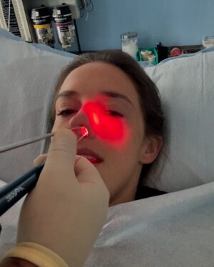 Rachel Ballinger Instagram - The stages of my nose surgery over the last 3 days. Y’all it was a JOURNEY! But we are over the biggest hump and easy breathing is in the near future! 😇☺️